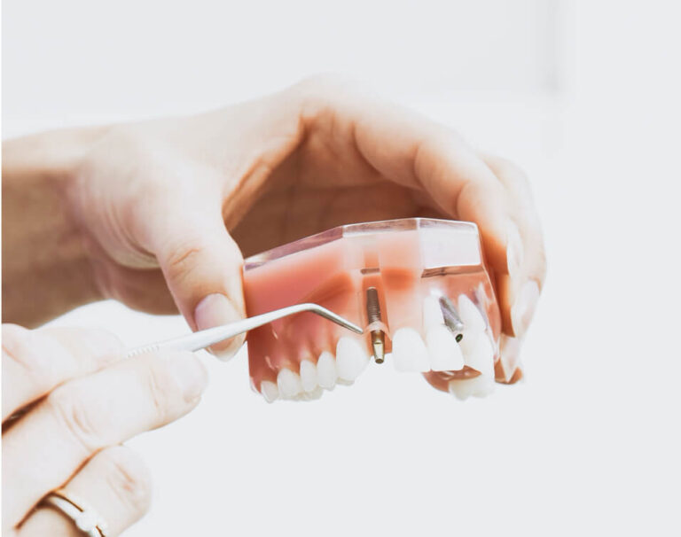 Cost of dental implants in Turkey