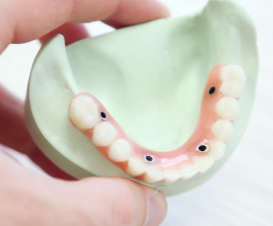 dental crowns in turkey