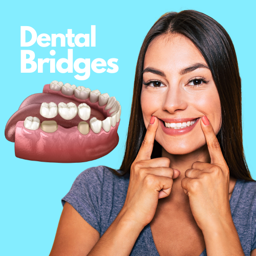 Dental Bridges: A Permanent Solution for Missing Teeth