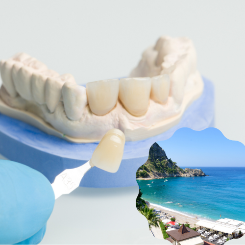 Dental veneers in Turkey