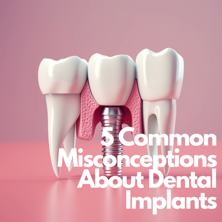 5 common misconceptions about dental implants